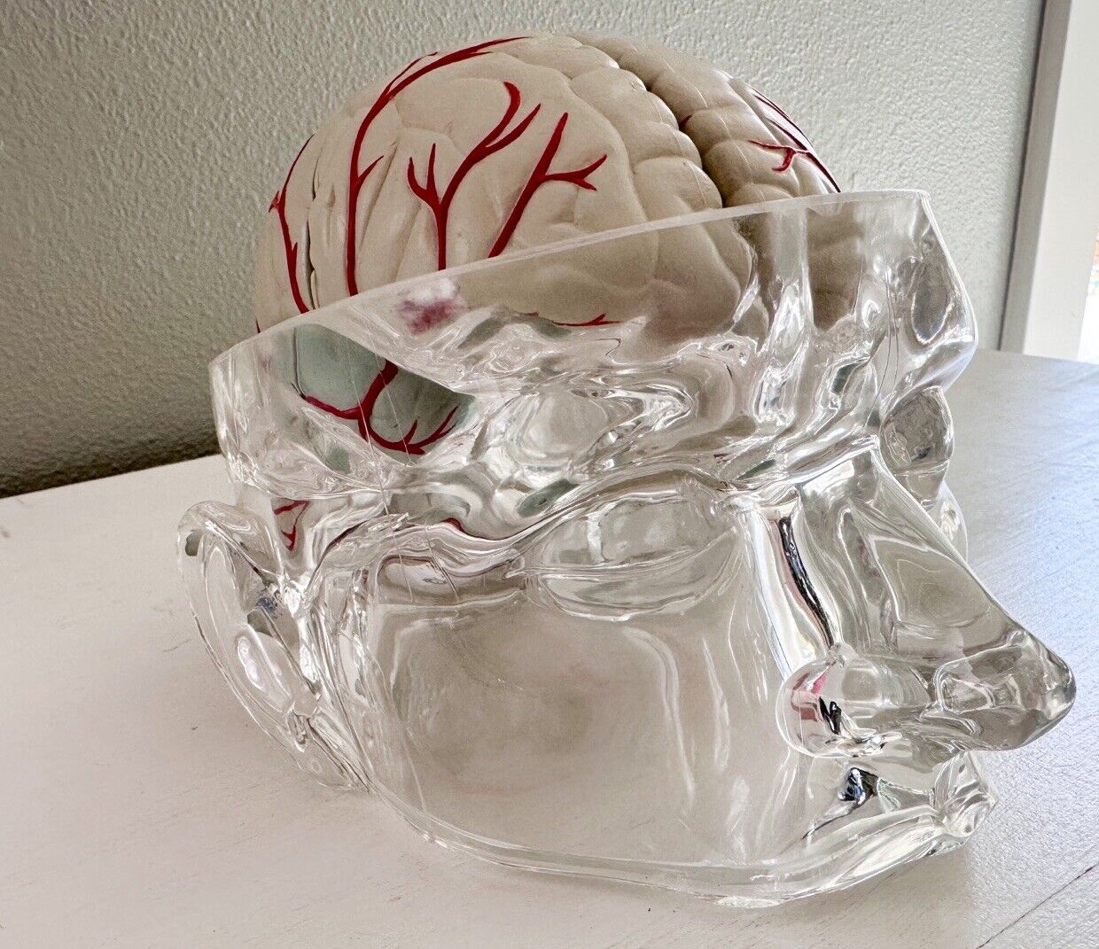 UCB Pharma Lucite Head Skull Brain Model Medical Pharmaceutical Science Display