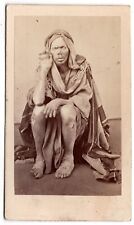 ANTIQUE CDV CIRCA 1860s MAN WITH LEPROSY SICK IN THE MIDDLE EAST RARE picture